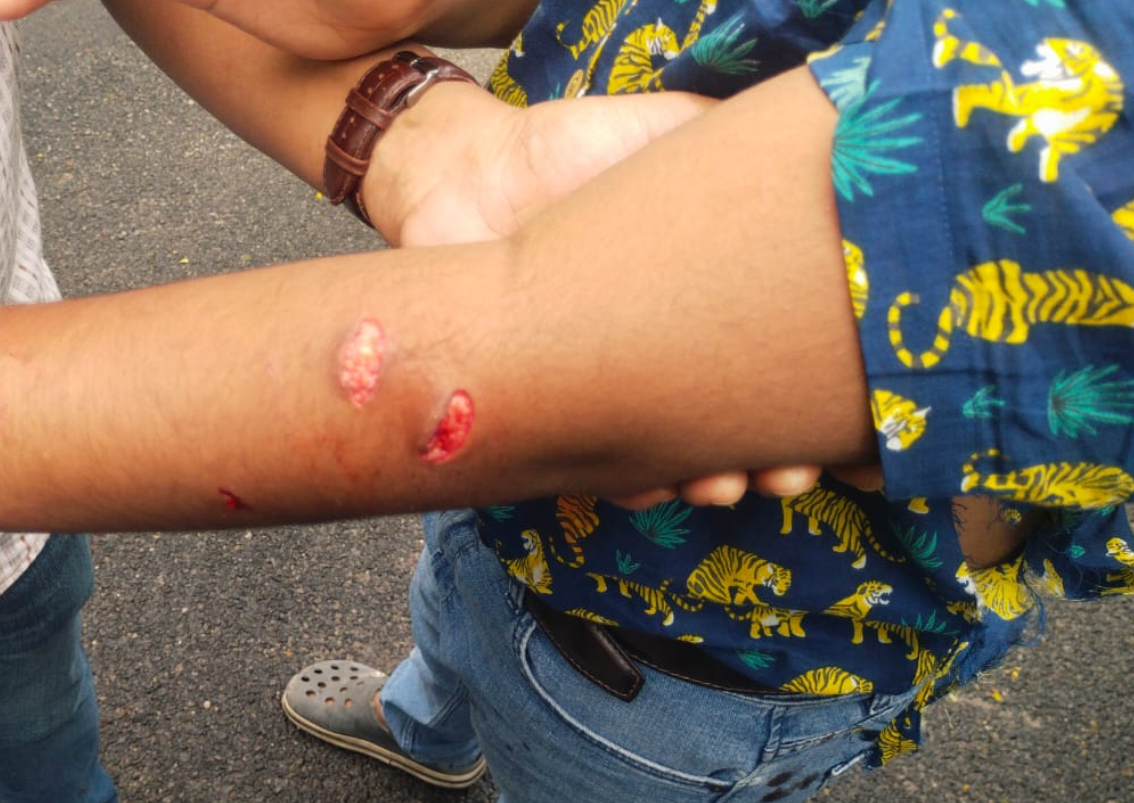 Bengaluru Leopard Safari Horror: 13-Year-Old Boy Injured in Bannerghatta Biological Park Attack