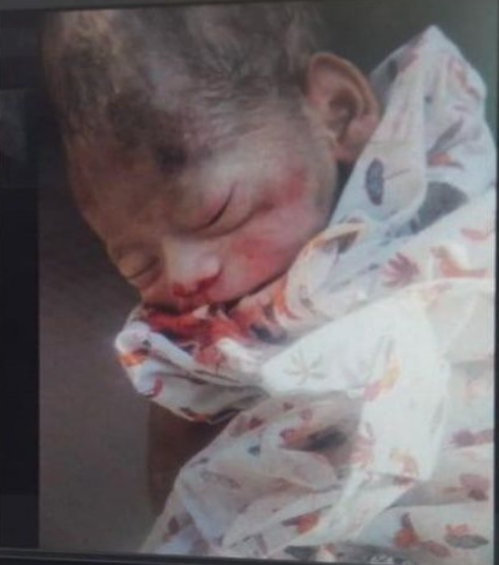 Bengaluru: Newborn baby abandoned near petrol pump rescued: Police reached the spot in 7 minutes